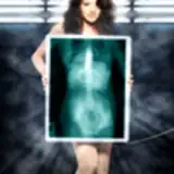 веселые рентгеновские лучи