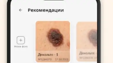 Про родинки скриншот 5