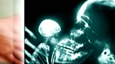 веселые рентгеновские лучи скриншот 3