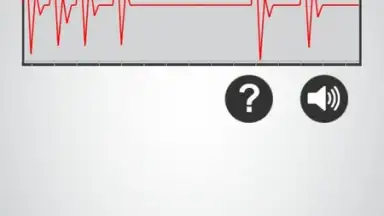 Monitor Heart Rate скриншот 5