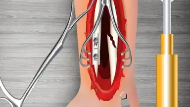 WristSurgeryDoctor скриншот 15