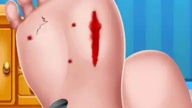 Foot Surgery Doctor Care скриншот 1