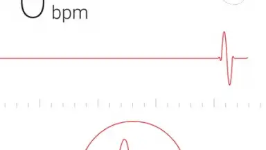 Cardiograph скриншот 5