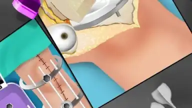 KneeSurgery скриншот 1