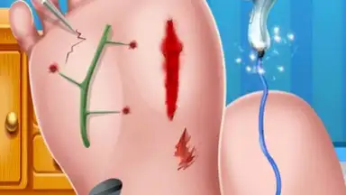 Foot Surgery Doctor Care скриншот 10