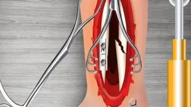 WristSurgeryDoctor скриншот 9
