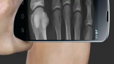 X Ray Scanner Pro скриншот 1