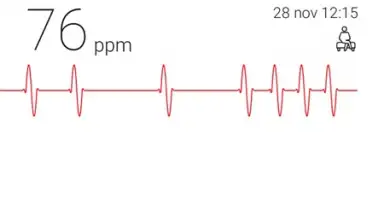 Cardiograph скриншот 2