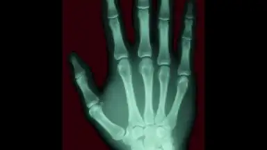 Scanner X-ray скриншот 5