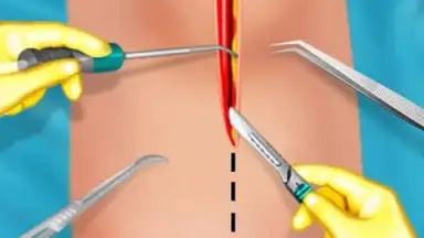 KneeSurgery скриншот 2