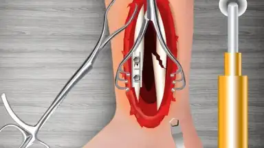 WristSurgeryDoctor скриншот 2