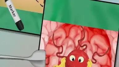 BrainSurgery скриншот 2