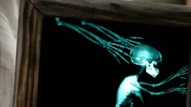 веселые рентгеновские лучи скриншот 8