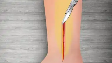 WristSurgeryDoctor скриншот 16