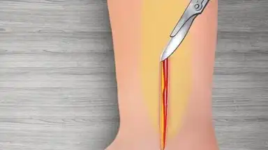 WristSurgeryDoctor скриншот 10