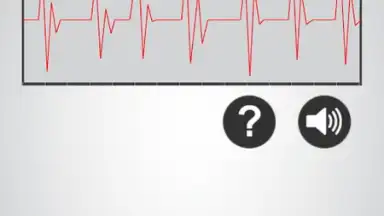 Heart Rate Monitor скриншот 2