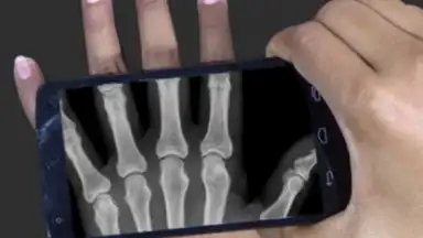 X Ray Scanner Pro скриншот 2