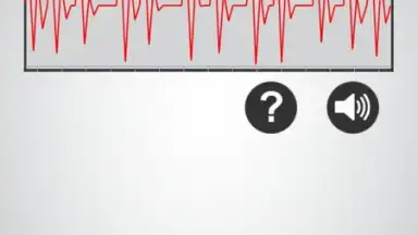 Monitor Heart Rate скриншот 1